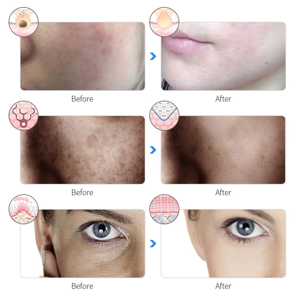 Masque LED sans fil 7 couleurs masque facial LED Photon peau raffermissant Anti-âge rajeunissement masque de beauté Machine – Image 4